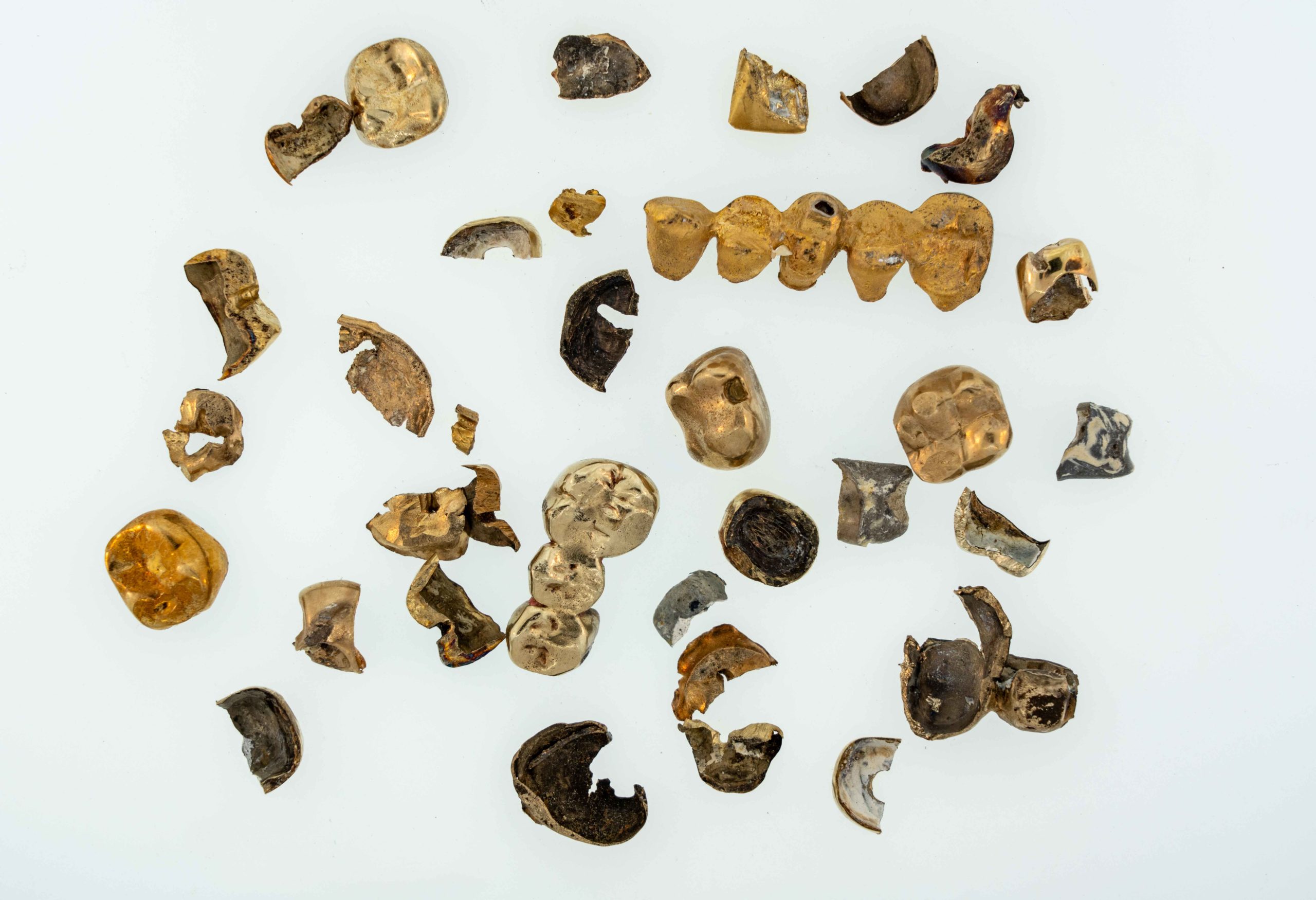 Sell your Gold and Silver Dental Gold Bridge